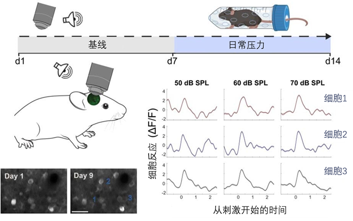 听力快讯丨神经科学家揭示压力如何重塑大脑的听觉处理机制-杭州听工场科技有限公司