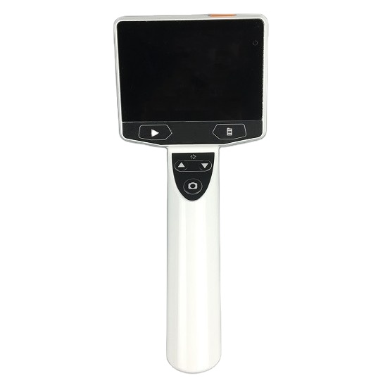 Wholesale High Quality Hearing Protector Riester HD Visual Video Otoscope Digital White USB Surgery Medical Hospital Use