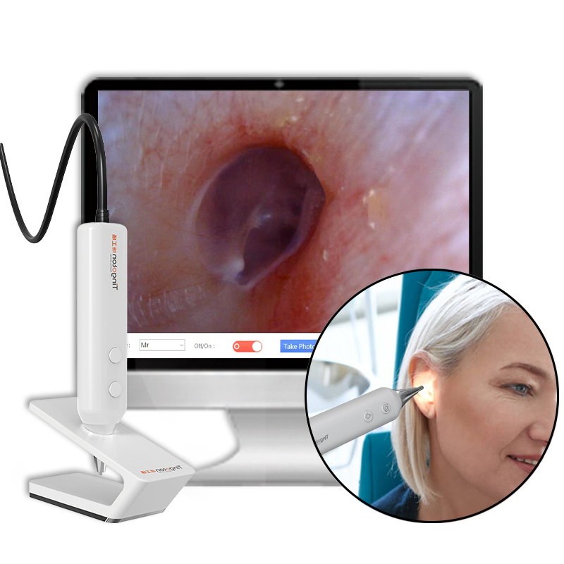 New Model Best Price High-quality Intelligent OEM Inspection Otoscope Ear Endoscope Camera 1280x720 Resolution 30FPS MJPG USB