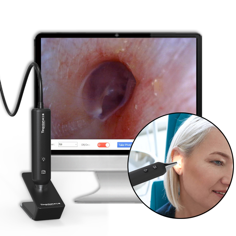 TINGOTON New Product Digital LED Light Ent Endoscope Otoscope Microscope with Camera