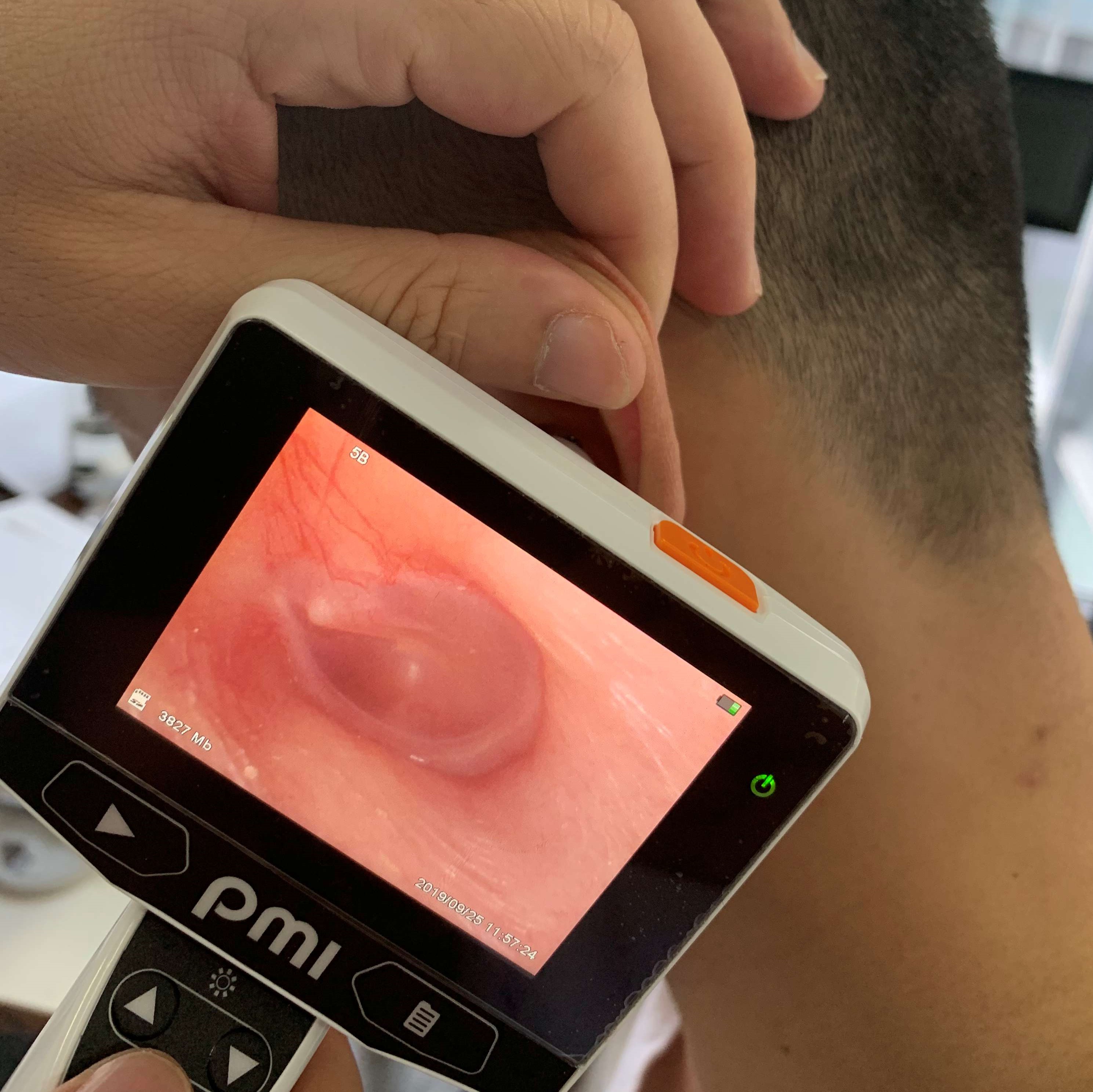 Wholesale High Quality Hearing Protector Riester HD Visual Video Otoscope Digital White USB Surgery Medical Hospital Use product detail