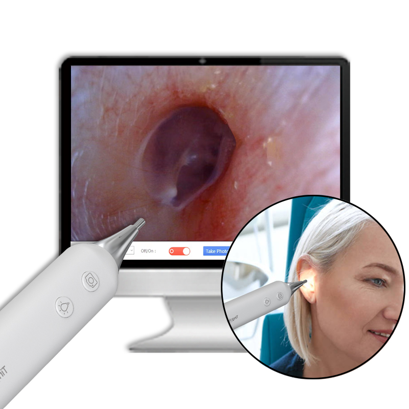 Tingoton Design Digital Ear Otoscope Camera with USB Adjustable LED Light Source 30FPS Black White Color MJPG Easy to Operate product detail